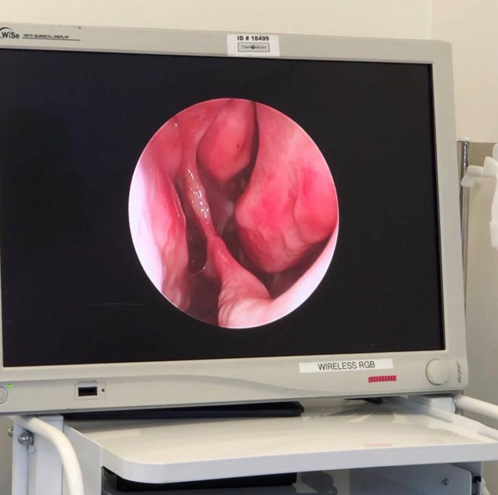endoscopichna-hirurgiya