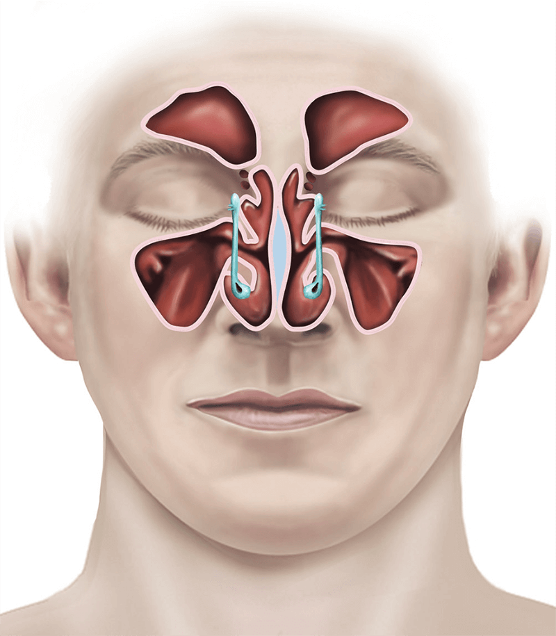 endoscopichna-hirurgiya